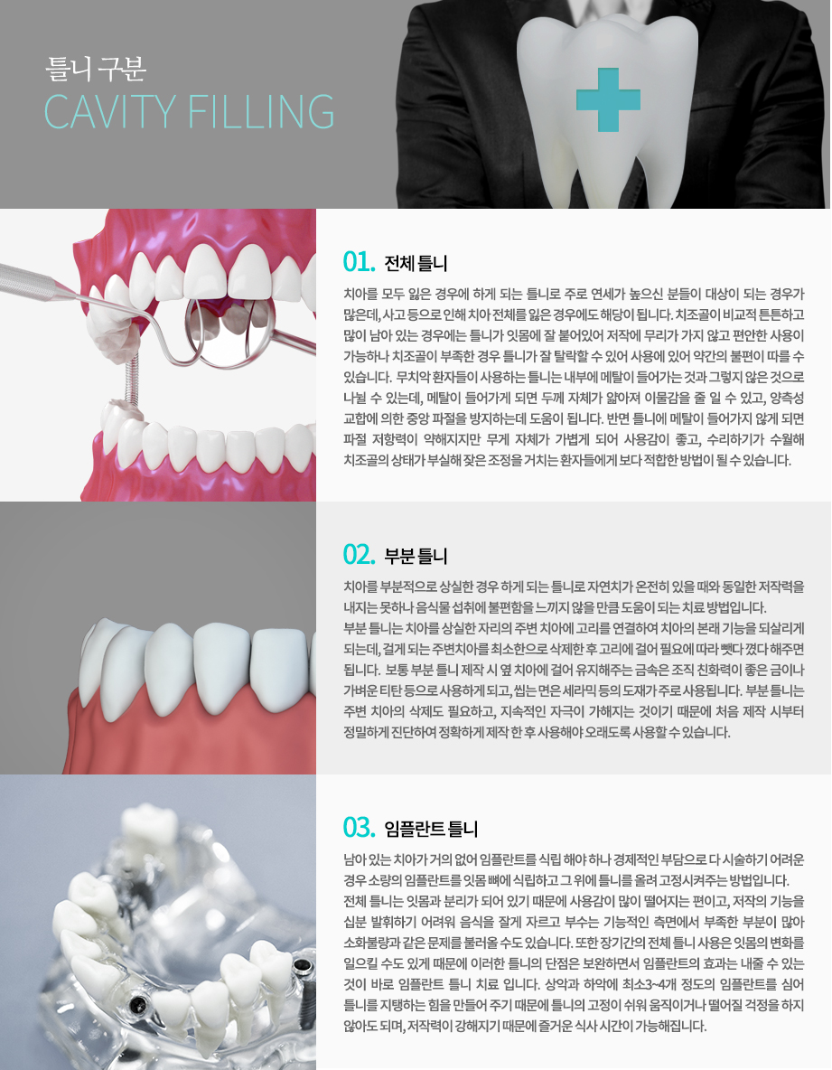 틀니 구분
-전체 틀니
치아를 모두 잃은 경우에 하게 되는 틀니로 주로 연세가 높으신 분들이 대상이 되는 경우가 많은데, 사고 등으로 인해 치아 전체를 잃은 경우에도 해당이 됩니다.
치조골이 비교적 튼튼하고 많이 남아 있는 경우에는 틀니가 잇몸에 잘 붙어있어 저작에 무리가 가지 않고 편안한 사용이 가능하나 치조골이 부족한 경우 틀니가 잘 탈락할 수 있어 사용에 있어 약간의 불편이 따를 수 있습니다. 
무치악 환자들이 사용하는 틀니는 내부에 메탈이 들어가는 것과 그렇지 않은 것으로 나뉠 수 있는데, 메탈이 들어가게 되면 두께 자체가 얇아져 이물감을 줄 일 수 있고, 양측성 교합에 의한 중앙 파절을 방지하는데 도움이 됩니다. 반면 틀니에 메탈이 들어가지 않게 되면 파절 저항력이 약해지지만 무게 자체가 가볍게 되어 사용감이 좋고, 수리하기가 수월해 치조골의 상태가 부실해 잦은 조정을 거치는 환자들에게 보다 적합한 방법이 될 수 있습니다.
-부분 틀니
치아를 부분적으로 상실한 경우 하게 되는 틀니로 자연치가 온전히 있을 때와 동일한 저작력을 내지는 못하나 음식물 섭취에 불편함을 느끼지 않을 만큼 도움이 되는 치료 방법입니다.
부분 틀니는 치아를 상실한 자리의 주변 치아에 고리를 연결하여 치아의 본래 기능을 되살리게 되는데, 걸게 되는 주변치아를 최소한으로 삭제한 후 고리에 걸어 필요에 따라 뺏다 꼈다 해주면 됩니다. 
보통 부분 틀니 제작 시 옆 치아에 걸어 유지해주는 금속은 조직 친화력이 좋은 금이나 가벼운 티탄 등으로 사용하게 되고, 씹는 면은 세라믹 등의 도재가 주로 사용됩니다. 
부분 틀니는 주변 치아의 삭제도 필요하고, 지속적인 자극이 가해지는 것이기 때문에 처음 제작 시부터 정밀하게 진단하여 정확하게 제작 한 후 사용해야 오래도록 사용할 수 있습니다.
-임플란트 틀니
남아 있는 치아가 거의 없어 임플란트를 식립 해야 하나 경제적인 부담으로 다 시술하기 어려운 경우 소량의 임플란트를 잇몸 뼈에 식립하고 그 위에 틀니를 올려 고정시켜주는 방법입니다.
전체 틀니는 잇몸과 분리가 되어 있기 때문에 사용감이 많이 떨어지는 편이고, 저작의 기능을 십분 발휘하기 어려워 음식을 잘게 자르고 부수는 기능적인 측면에서 부족한 부분이 많아 소화불량과 같은 문제를 불러올 수도 있습니다. 또한 장기간의 전체 틀니 사용은 잇몸의 변화를 일으킬 수도 있게 때문에 이러한 틀니의 단점은 보완하면서 임플란트의 효과는 내줄 수 있는 것이 바로 임플란트 틀니 치료 입니다.
상악과 하악에 최소3~4개 정도의 임플란트를 심어 틀니를 지탱하는 힘을 만들어 주기 때문에 틀니의 고정이 쉬워 움직이거나 떨어질 걱정을 하지 않아도 되며, 저작력이 강해지기 때문에 즐거운 식사 시간이 가능해집니다. 

