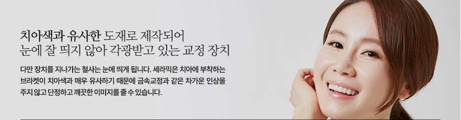 치아색과 유사한 도재로 제작되어 눈에 잘 띄지 않아 각광받고 있는 교정 장치로 다만 장치를 지나가는 철사는 눈에 띄게 됩니다. 세라믹은 치아에 부착하는 브라켓이 치아색과 매우 유사하기 때문에 금속교정과 같은 차가운 인상을 주지 않고 단정하고 깨끗한 이미지를 줄 수 있습니다.

